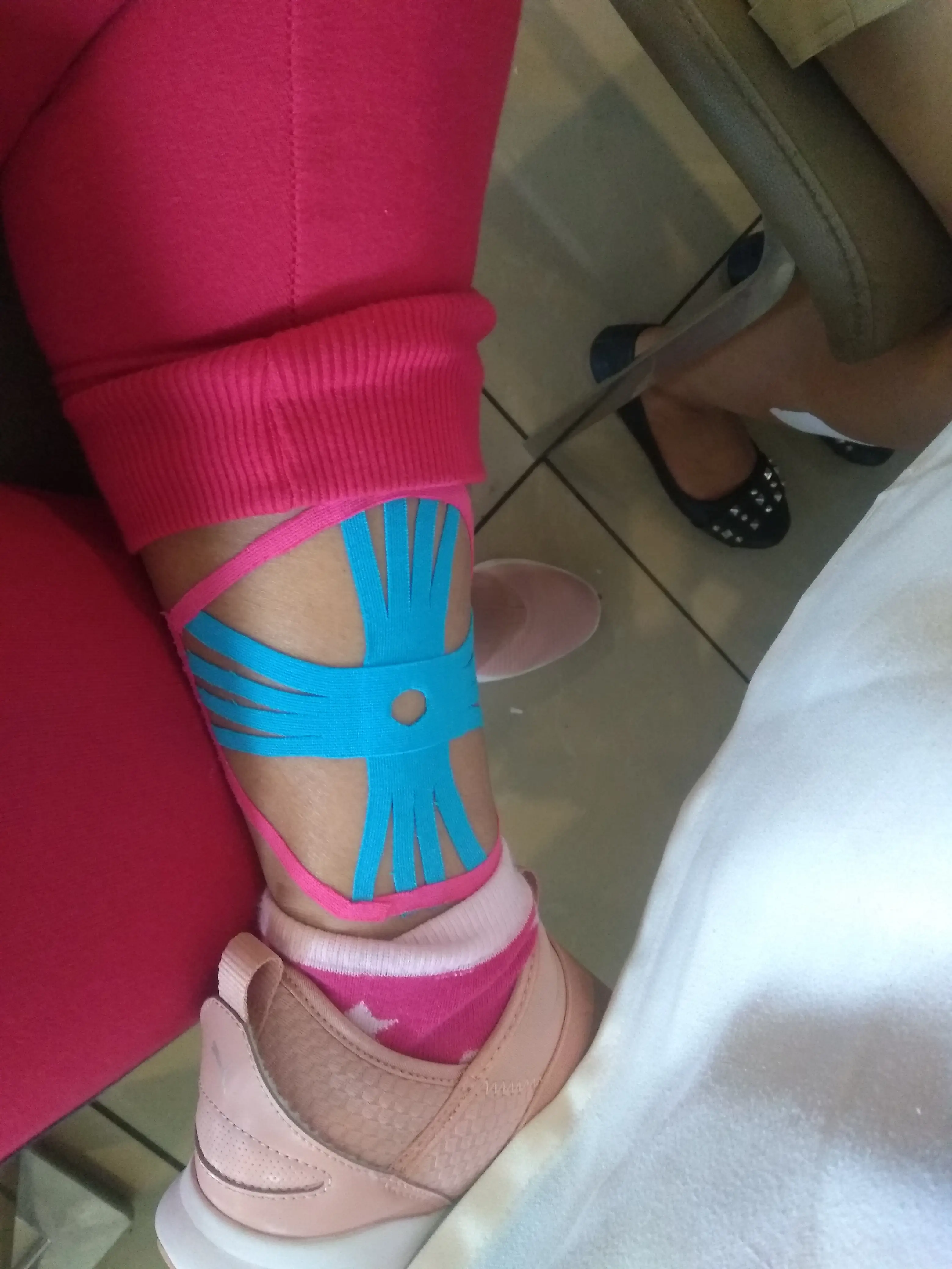 Kinesio taping for sports injury